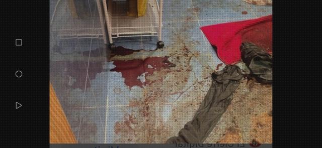 Review de campana extractora de sangre